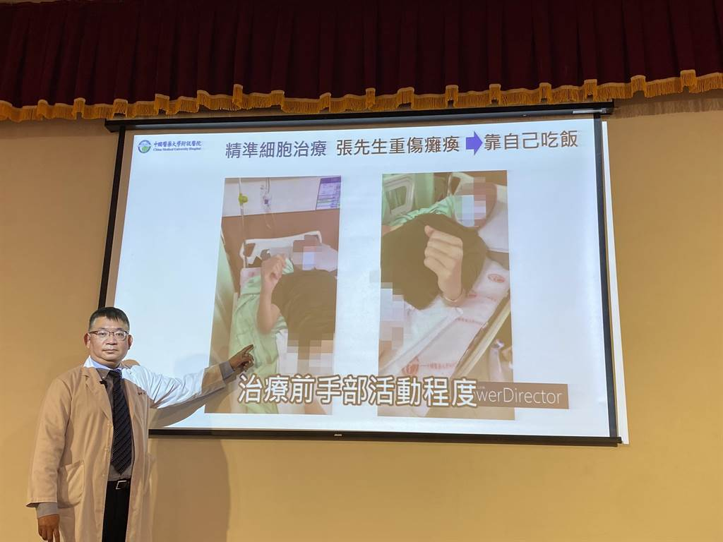 4位患者的自述:选择干细胞治疗脊髓损伤的心路历程与效果体验 7 20250924194714 68d3da426f17d