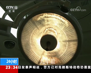 3位渐冻症患者的自述:选择干细胞治疗的心路历程与效果体验 4 20250924194732 68d3da546cc22