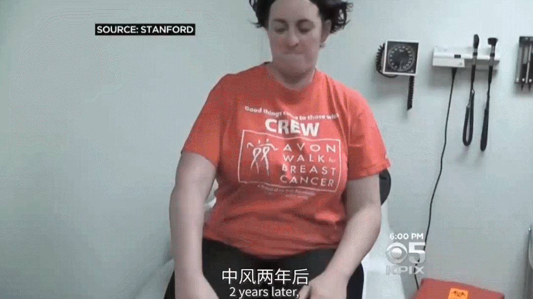 3位中风患者亲述:干细胞治疗中风后的真实改变与心路历程 6 干细胞治疗前