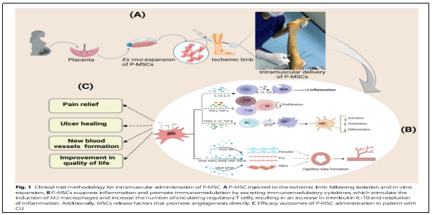 干细胞治疗严重肢体缺血:I期临床试验报告安全性与可行性 | 患者希望 3 20250924200138 68d3dda2181fb
