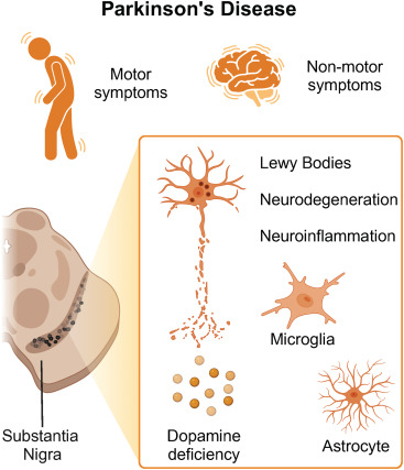 从静息到激活:回输干细胞促使靶向脑室下区的神经干细胞实现帕金森病原位神经再生 2 图1:帕金森病的临床和神经病理学特征