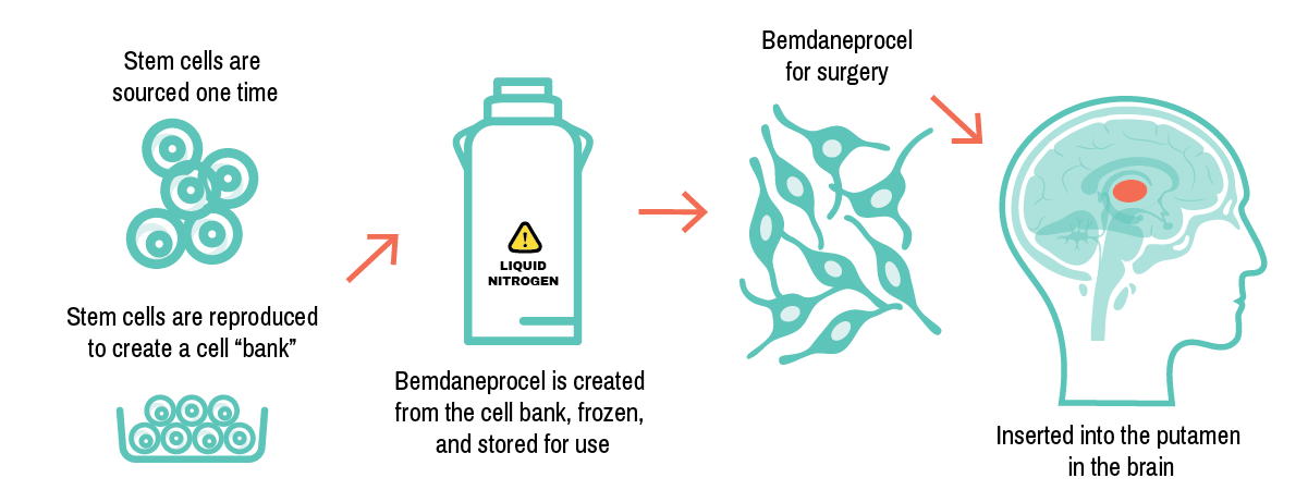 拜耳公司帕金森病干细胞新药bemdaneprocel进入关键性3期临床,完成首例患者给药 4 bemdaneprocel process v6