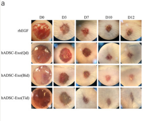 干细胞外泌体能治疗哪些疾病?8大适应症与最新案例分析 2 干细胞外泌体治疗的全层切除伤口的代表性照片
