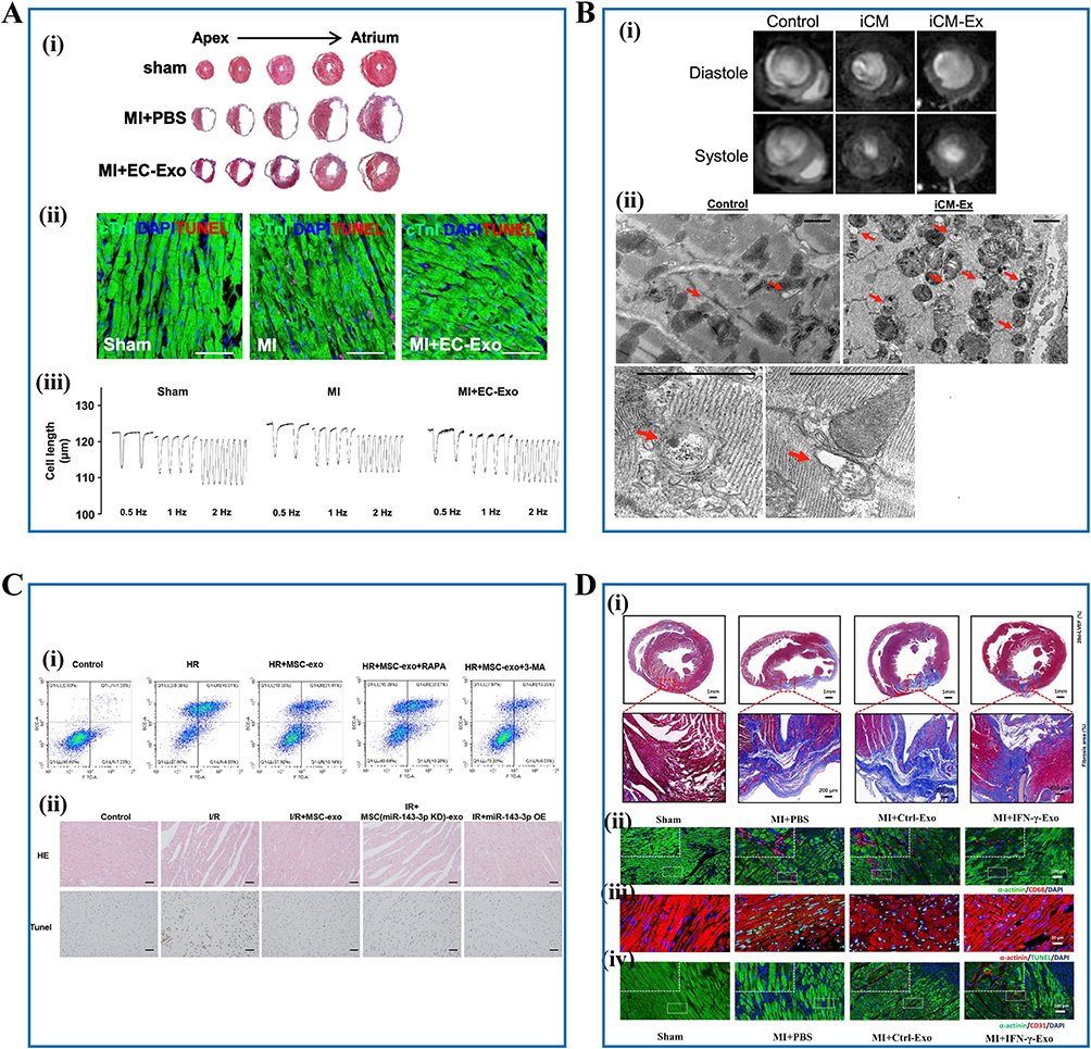 干细胞外泌体治疗效果揭秘:2025最新临床应用与研究进展 3 图1:干细胞外泌体在心血管疾病中的治疗应用