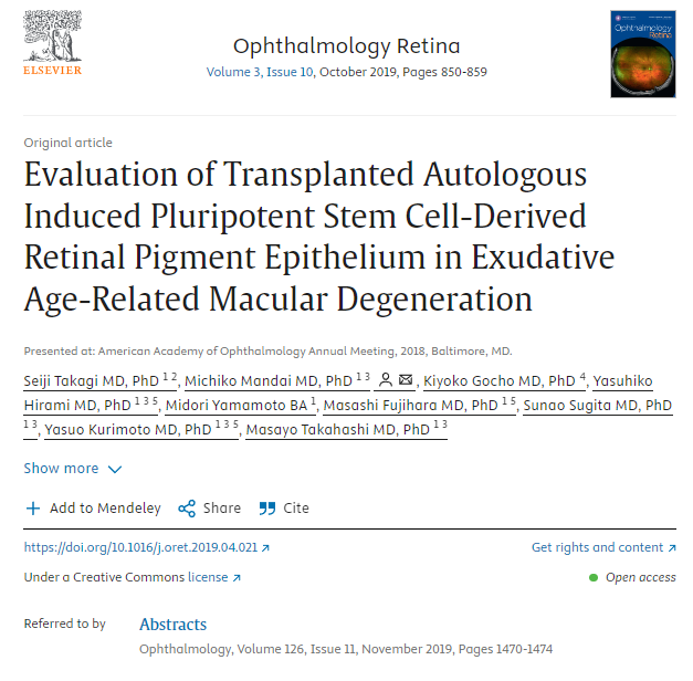 多能干细胞治疗效果如何?2025最新临床研究与真实案例汇总 5 自体诱导性多能干细胞来源的视网膜色素上皮移植治疗渗出性年龄相关性黄斑变性的效果评价