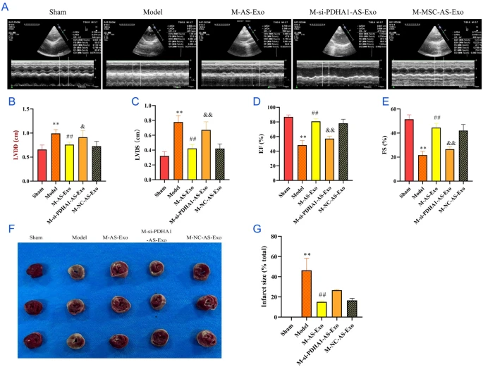 干细胞外泌体能治疗哪些疾病?8大适应症与最新案例分析 3 干细胞外泌体对心脏功能及炎症反应的影响