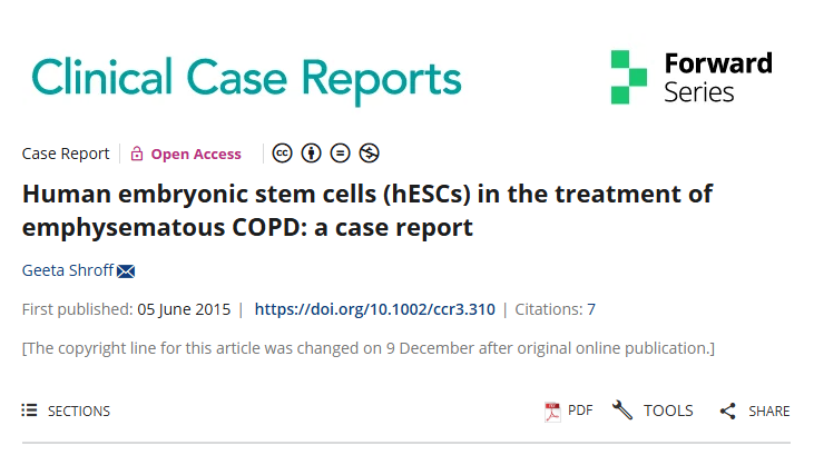 人类胚胎干细胞（hESCs）治疗肺气肿性慢性阻塞性肺病：病例报告