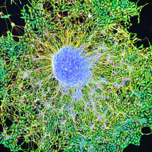 干细胞有哪几种?全面解析胚胎、成体与诱导多能干细胞的区别 2 胚胎干细胞分化为神经元。