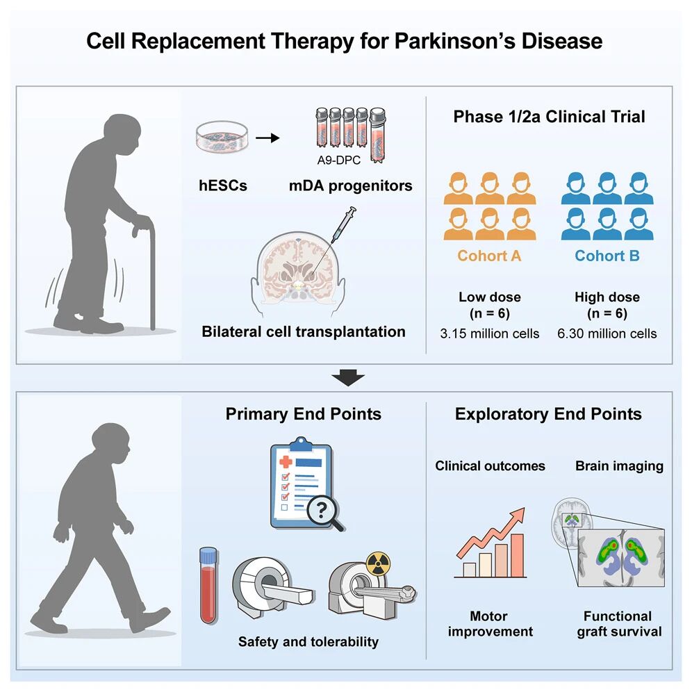 干细胞移植治疗帕金森病获突破:37岁患者移植3个月后实现“功能性治愈” 14 微信图片 2025 10 20 153959 105