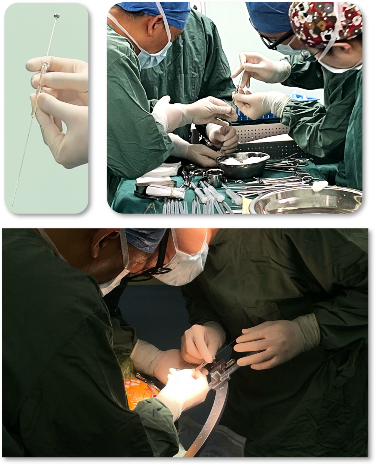 浙江首例!干细胞移植治疗帕金森病让69岁患者“重获新生”,从寸步难行到行走自如 2 微信图片 2025 10 29 140721 483