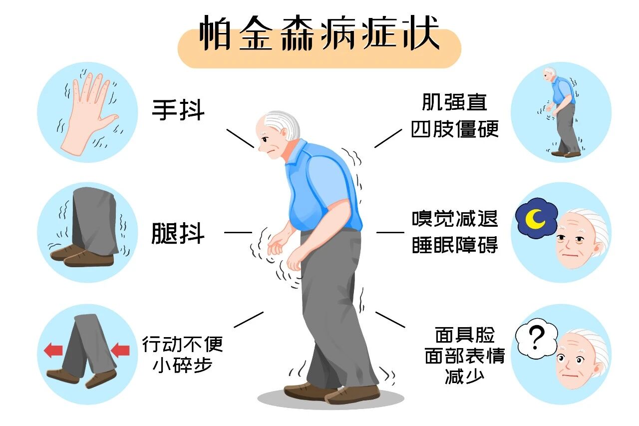 浙江首例！干细胞移植治疗帕金森病让69岁患者“重获新生”，从寸步难行到行走自如