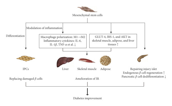 间充质干细胞治疗糖尿病:是理想候选疗法吗? 4 图1:间充质干细胞治疗糖尿病的机制