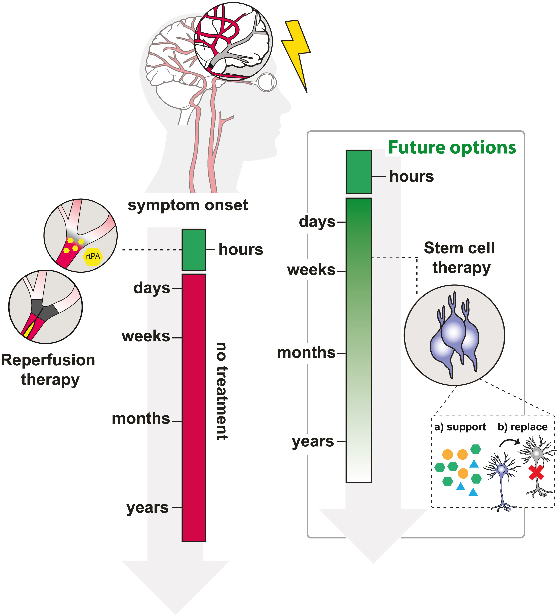 从瘫痪到复健!神经干细胞疗法5大机制如何促进中风后的大脑修复? 3 gr1 lrg 2