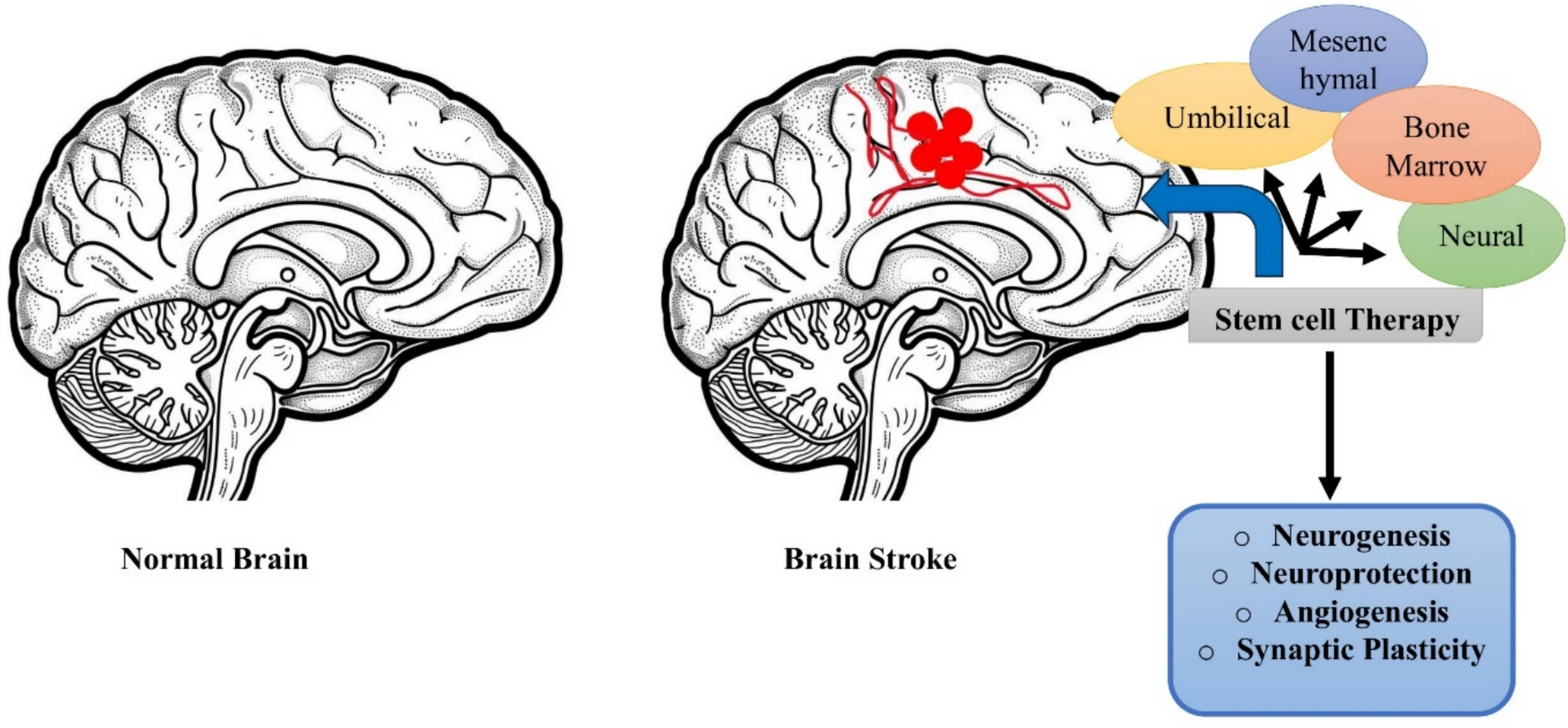 2025年干细胞治疗卒中的细胞递送方法、时机与临床进展 3 微信图片 2025 11 10 141738 153