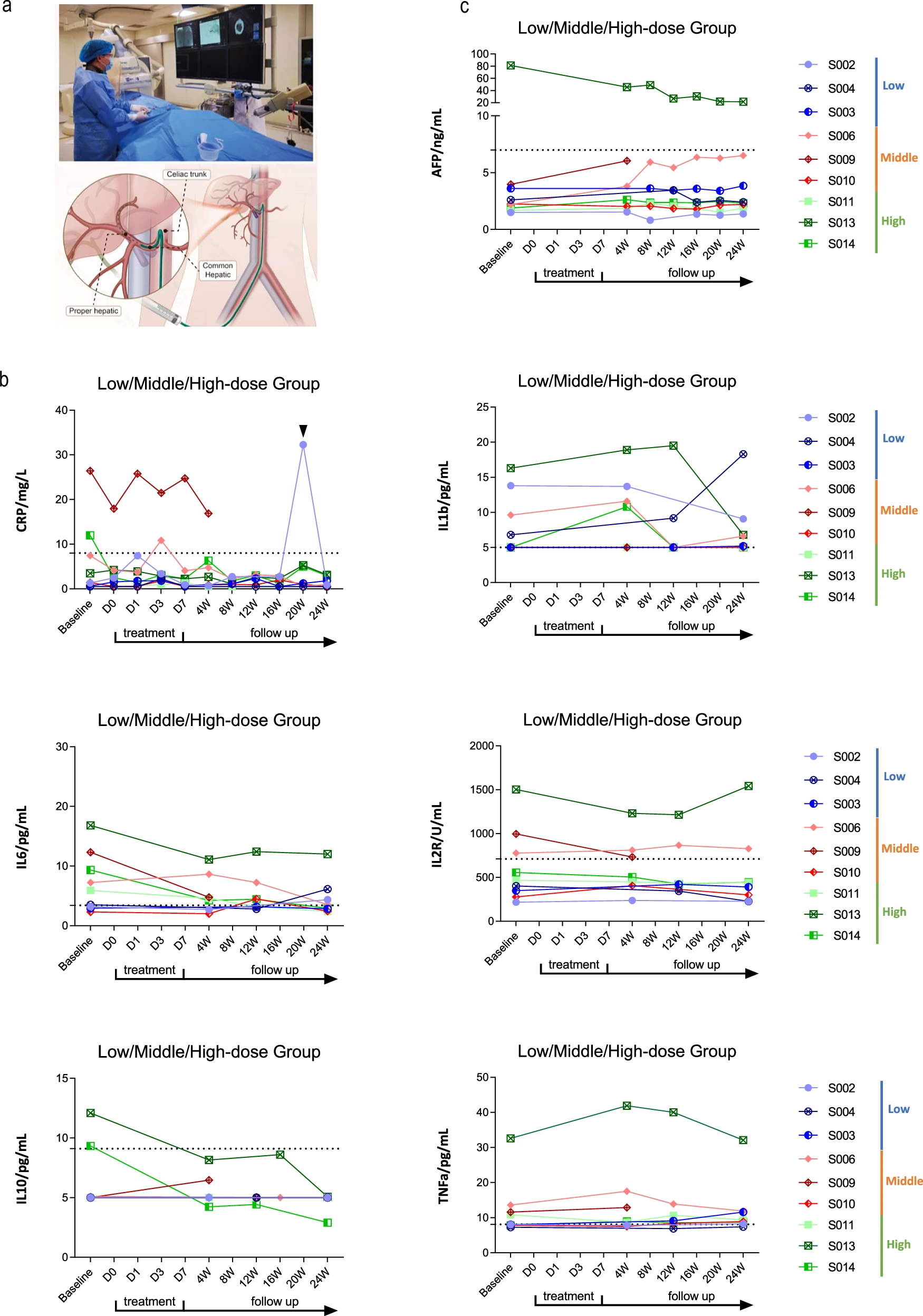 上海仁济医院:肝祖细胞治疗肝硬化6个月后,8例患者肝功能、凝血及纤维化指标显著改善 6 微信图片 2025 11 11 184447 618