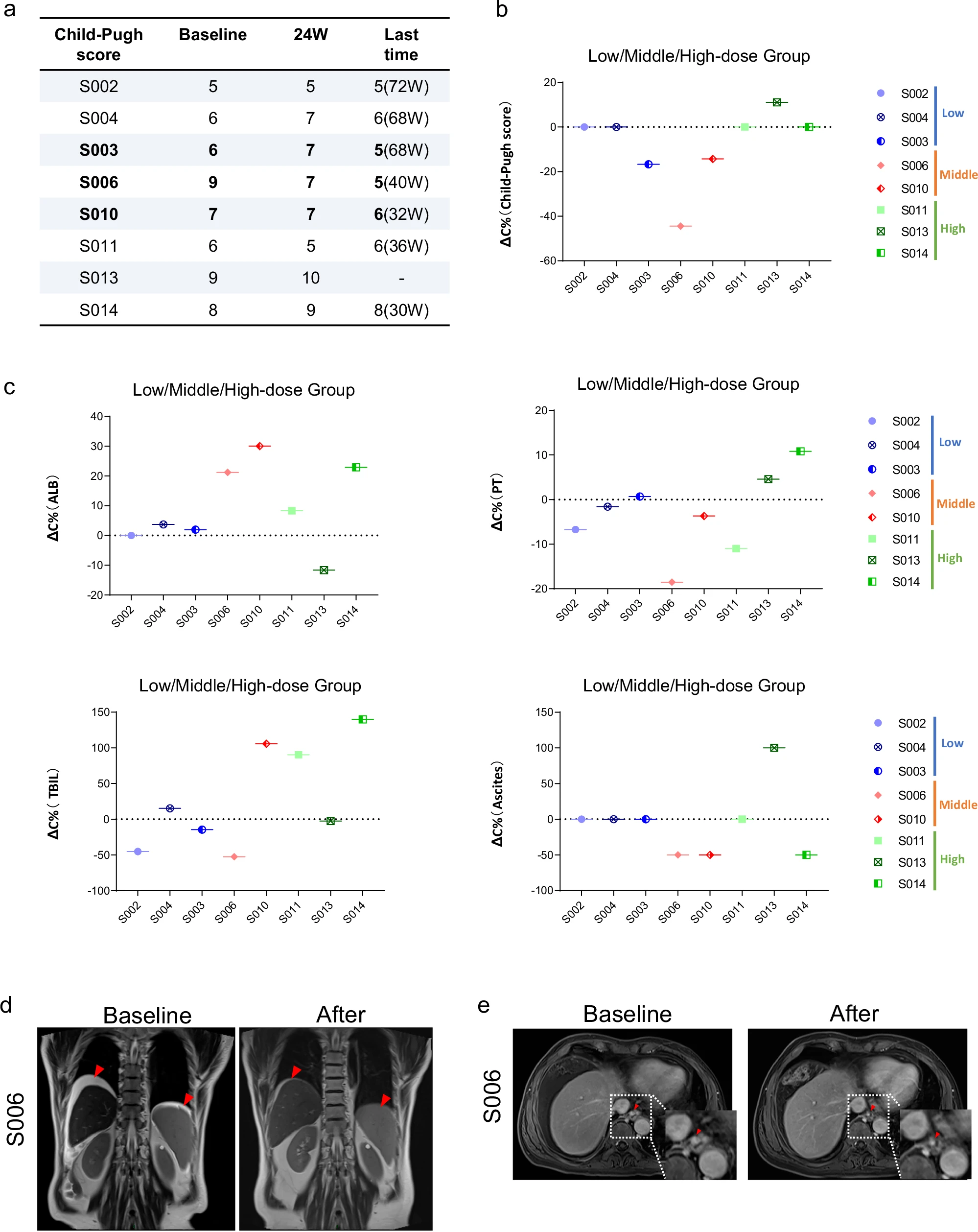 上海仁济医院:肝祖细胞治疗肝硬化6个月后,8例患者肝功能、凝血及纤维化指标显著改善 7 微信图片 2025 11 11 184529 793