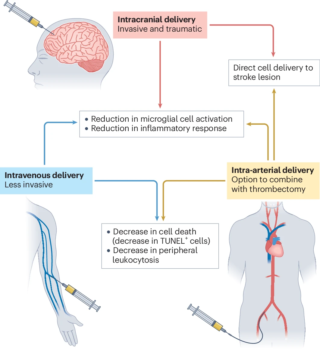 中风后康复新方法：干细胞作为“指挥官”调控微环境，免疫细胞作为“实干家”执行修复