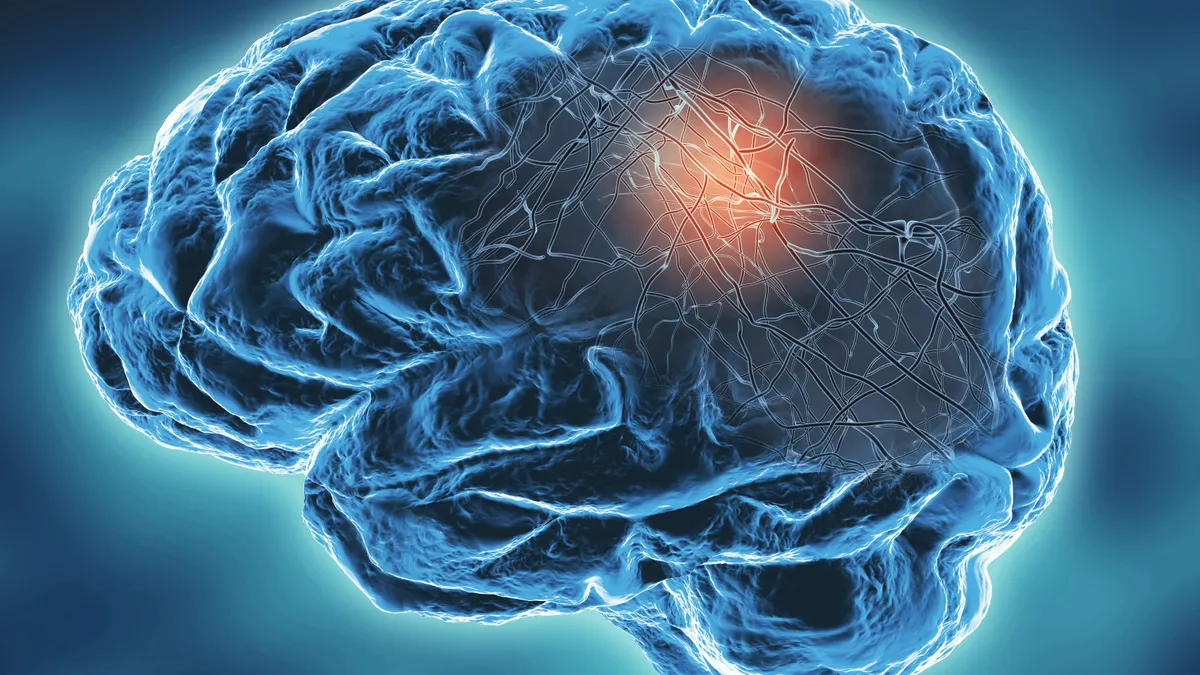 阿斯彭公司为干细胞治疗帕金森病筹集1.15亿美元