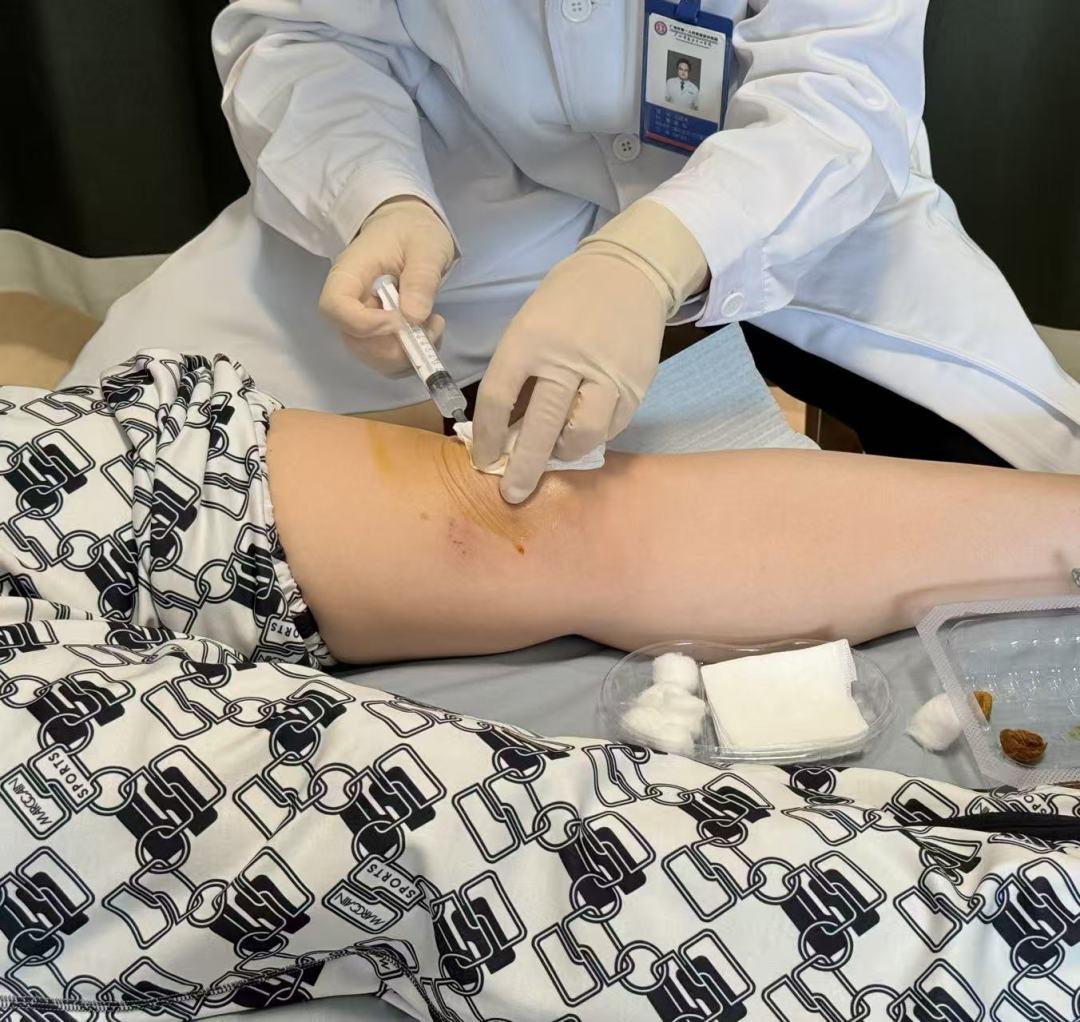 南沙干细胞治疗“先行先试”落地,已有47例患者受益,5种疾病临床应用 4 b16d2b6c94214a318a24e35d6ff0204d