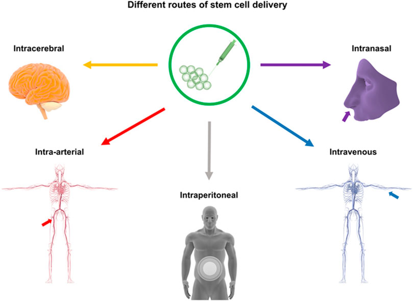 神经干细胞移植治疗脑出血的系统评价:NSC来源、输送途径、治疗机制和早期临床试验 4 fphar 16 1660614 g001