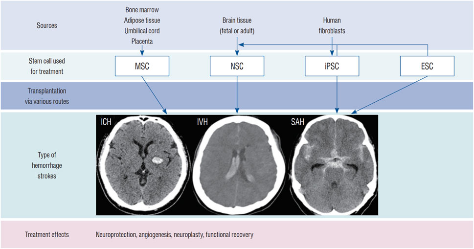 神经干细胞移植治疗脑出血的系统评价:NSC来源、输送途径、治疗机制和早期临床试验 11 fphar 16 1660614 g003