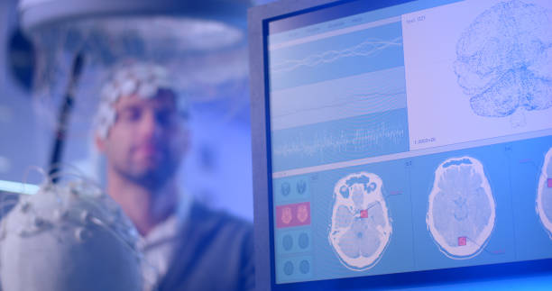 干细胞治疗与脑深部电刺激(DBS),帕金森病患者如何选择?1份权衡指南