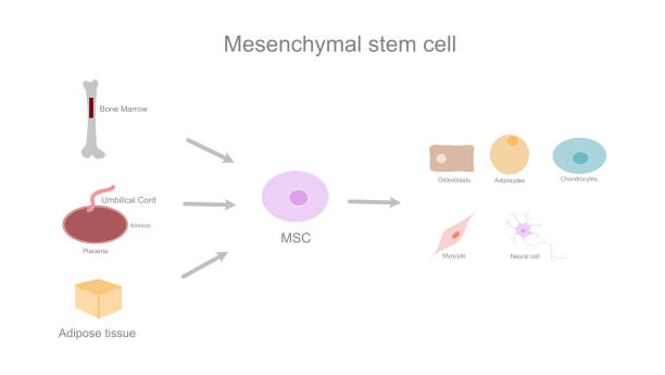 2025年干细胞治疗糖尿病11大核心问答:原理、疗效、风险及就医全攻略 1 2025年干细胞治疗糖尿病11大核心问答:原理、疗效、风险及就医全攻略