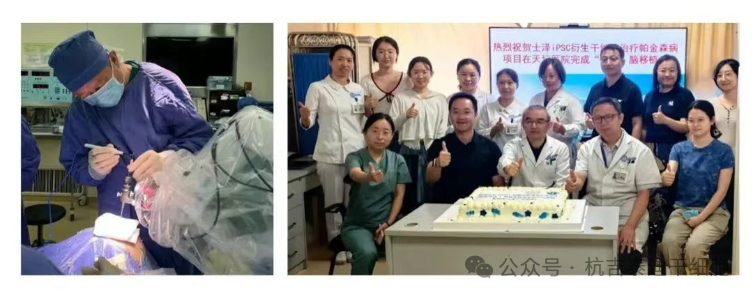 2025年(1-12月)干细胞治疗帕金森病的临床转化新趋势,让神经再生从梦想照进现实 11 微信图片 2025 12 12 161210 573