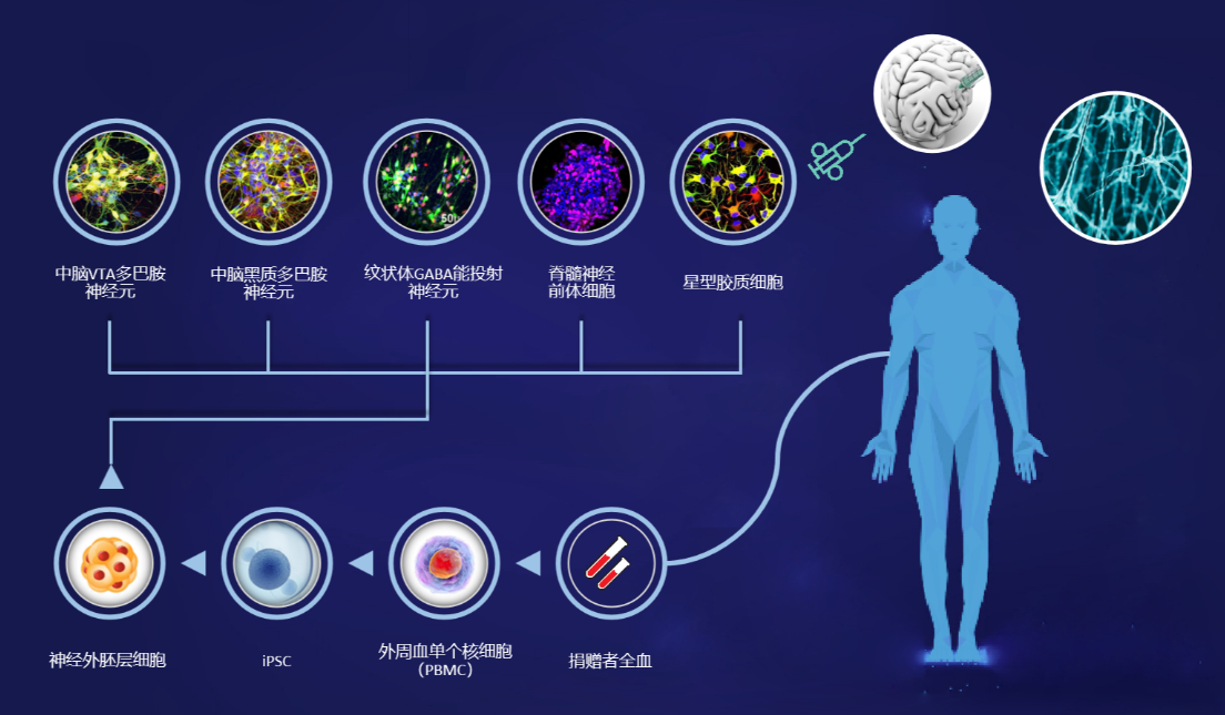 16项临床试验揭示胚胎与诱导多能干细胞治疗帕金森病的前景:多巴胺细胞疗法正推进 22 微信图片 2025 12 18 135912 834