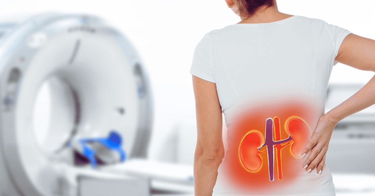 2025年1-12月：干细胞治疗狼疮性肾炎最新临床进展汇总