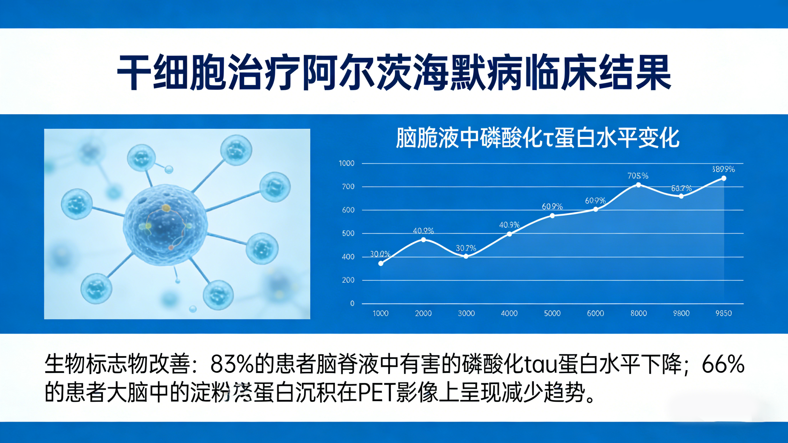 干细胞治疗阿尔茨海默病临床结果