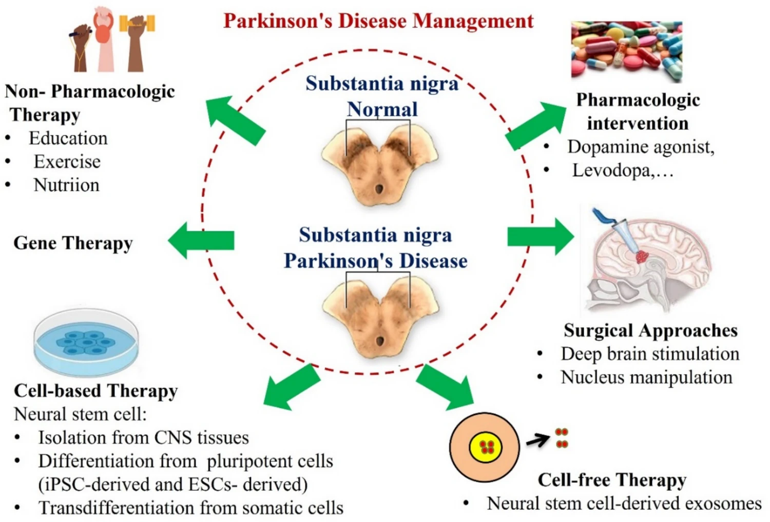 图4:帕金森病(PD)的治疗。黑质多巴胺能神经元的退化是PD的基本病理特征。 微信图片 2026 01 06 140250 699