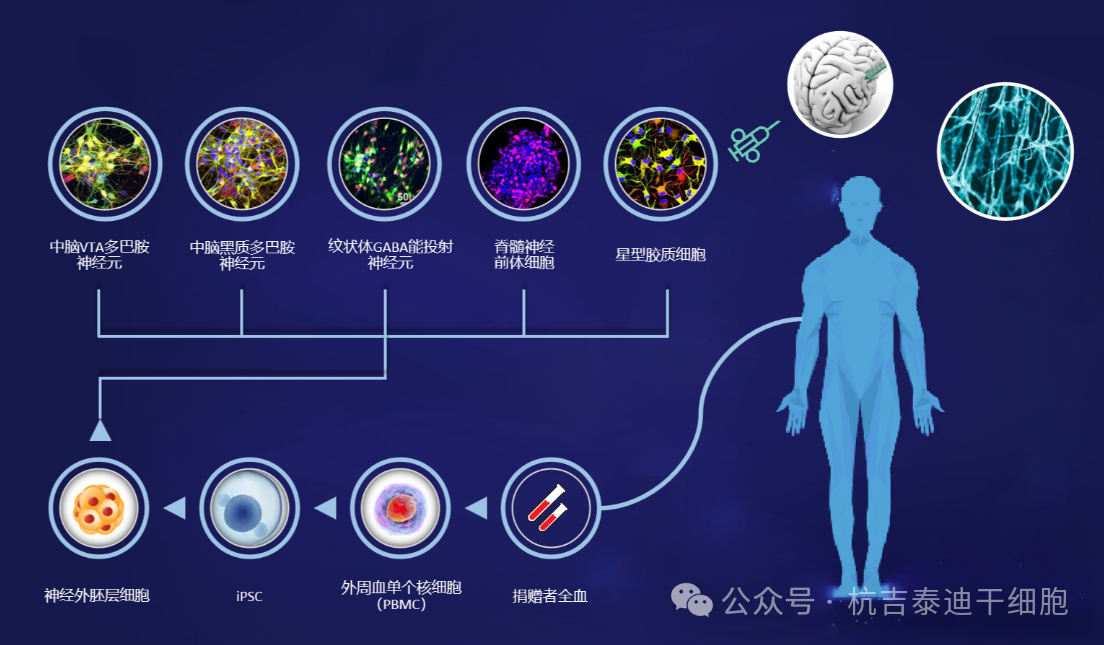 胚胎、诱导多能干细胞治疗帕金森病的前景可观：已有16项试验