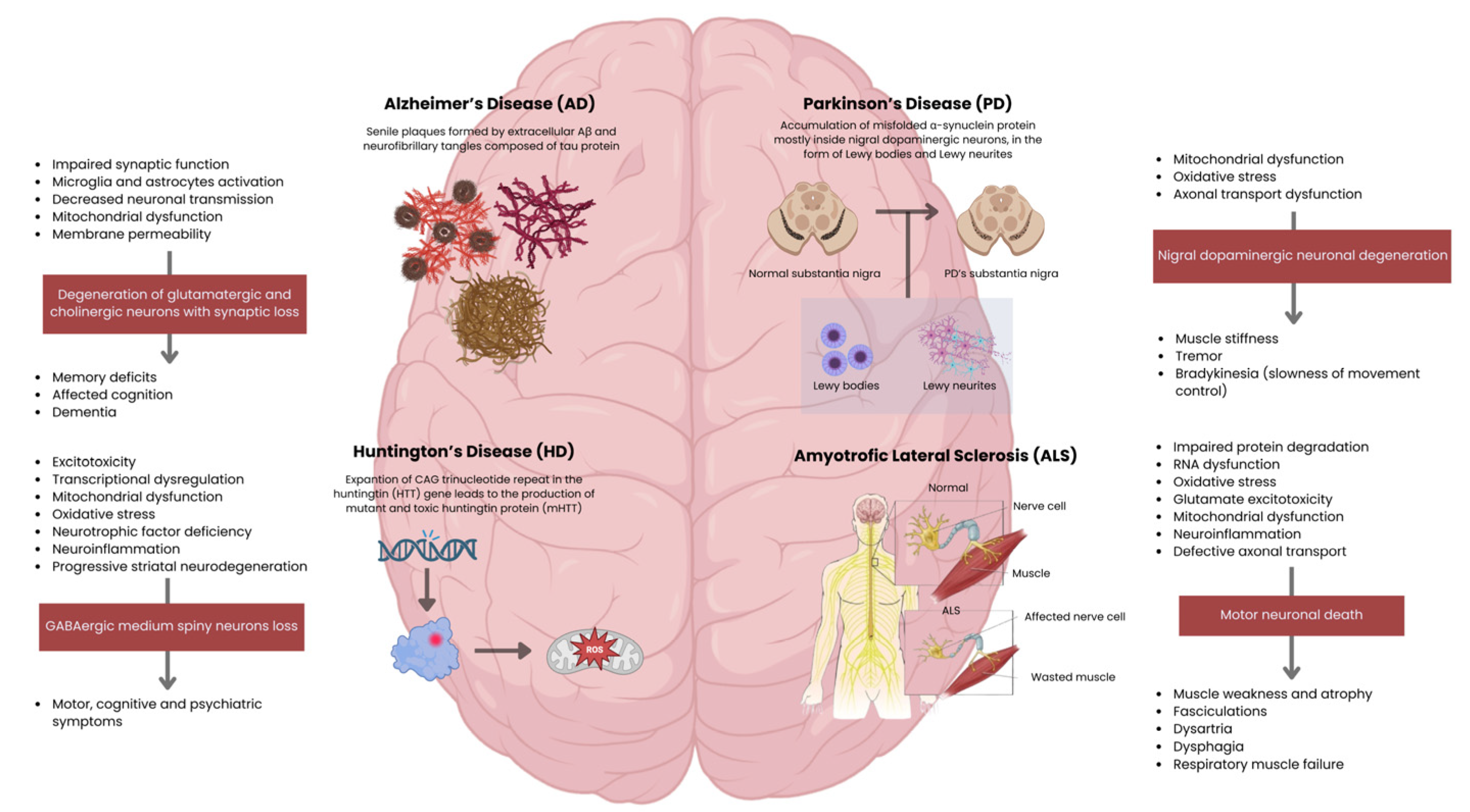 图2：主要神经退行性疾病的病理生理机制和临床特征。侧边栏概述了从细胞功能障碍到特定神经元丢失以及随后临床表现的进展过程。
